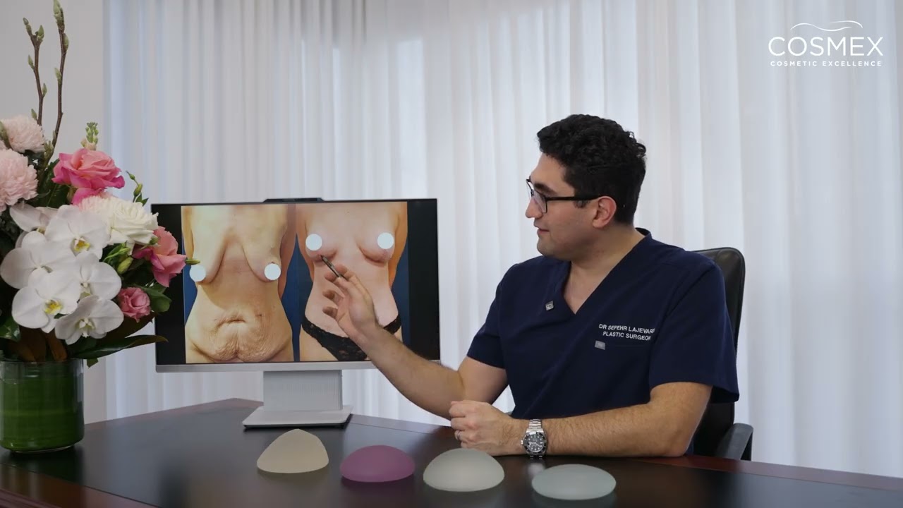  Breast Lift Mastopexy Do You Need Breast Implants
