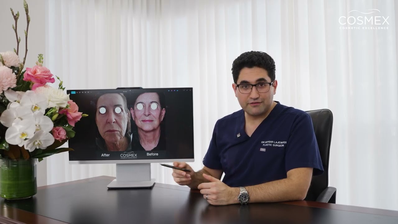  Facelift Surgery Factors That Can Affect Your Results