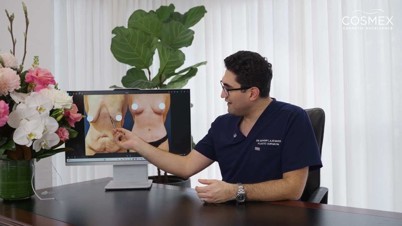  Can You Have Liposuction and a Tummy Tuck at the Same Time